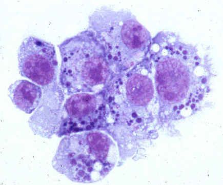 Agenți cauzali ai anaplasmozei umane (familia Anaplasmataceae)